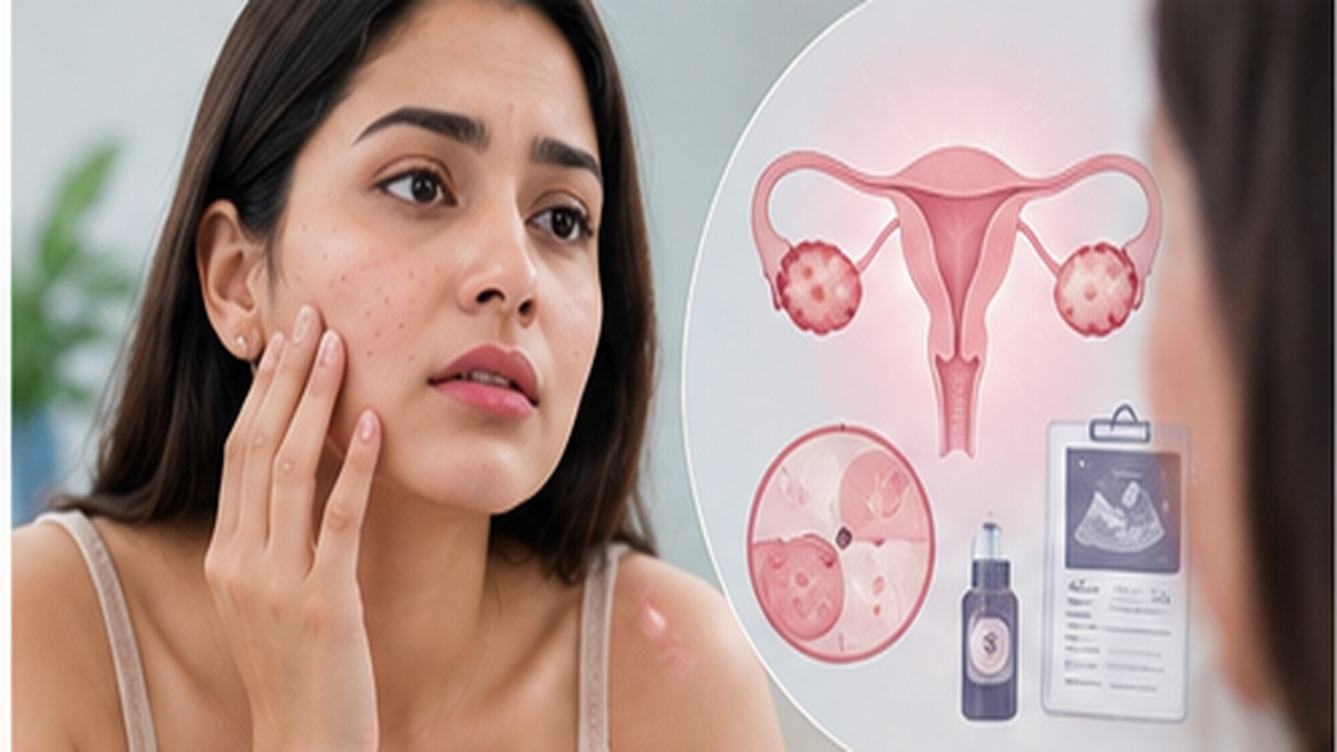 PMOS-PCOD Treatment consultation in Delhi